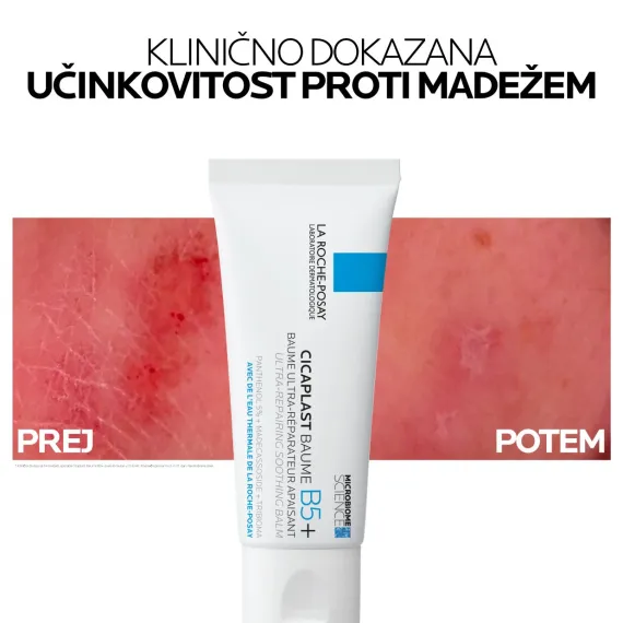 La Roche-Posay, Cicaplast Baume B5+, Ultra obnovitveni pomirjevalni balzam za razdraženo kožo, 100 ml