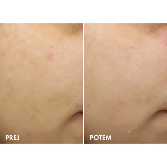 Vichy, Liftactiv Pigment Specialist B3 nočna krema proti hiperpigmentaciji, 50 ml