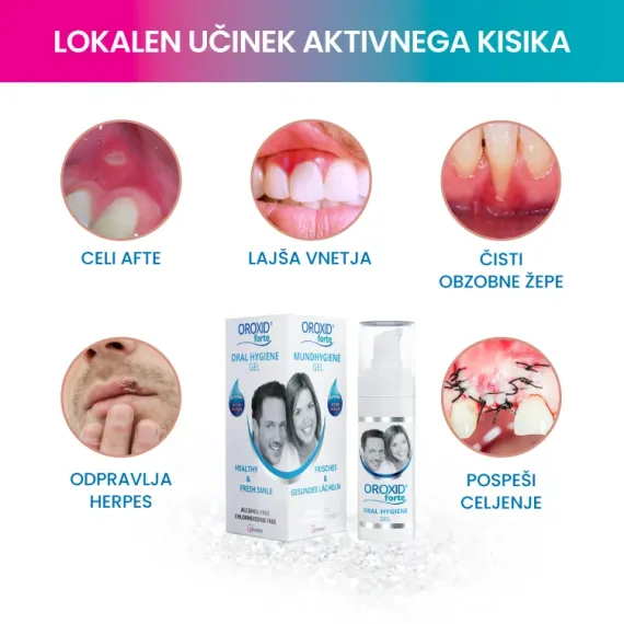 Oroxid forte oralni gel, 30 ml gel